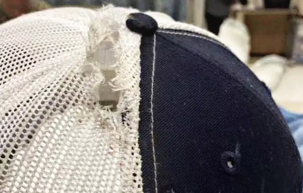 Bullet Grazed Border Patrol Agent’s Head During School Shooting [PHOTOS]