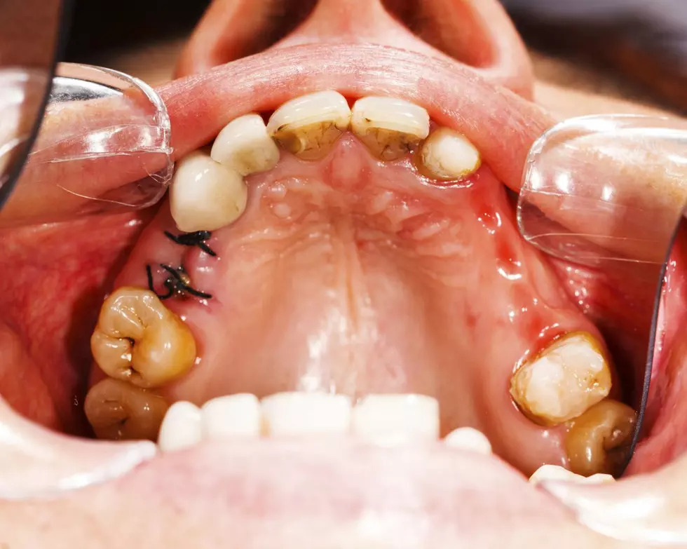 Is Stress Secretly Destroying Your Smile, New Jersey? New Data Confirms It Might Be